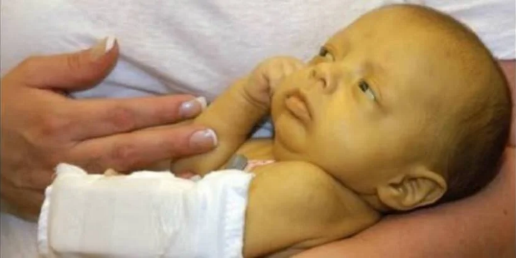 11)	Bayi Kuning 
