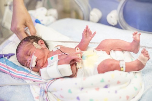 10)	Bayi Prematur 