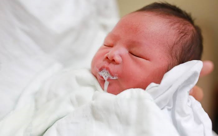 7)	Bayi Beser atau Gumoh Berlebihan