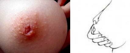 8)	Puting Datar 