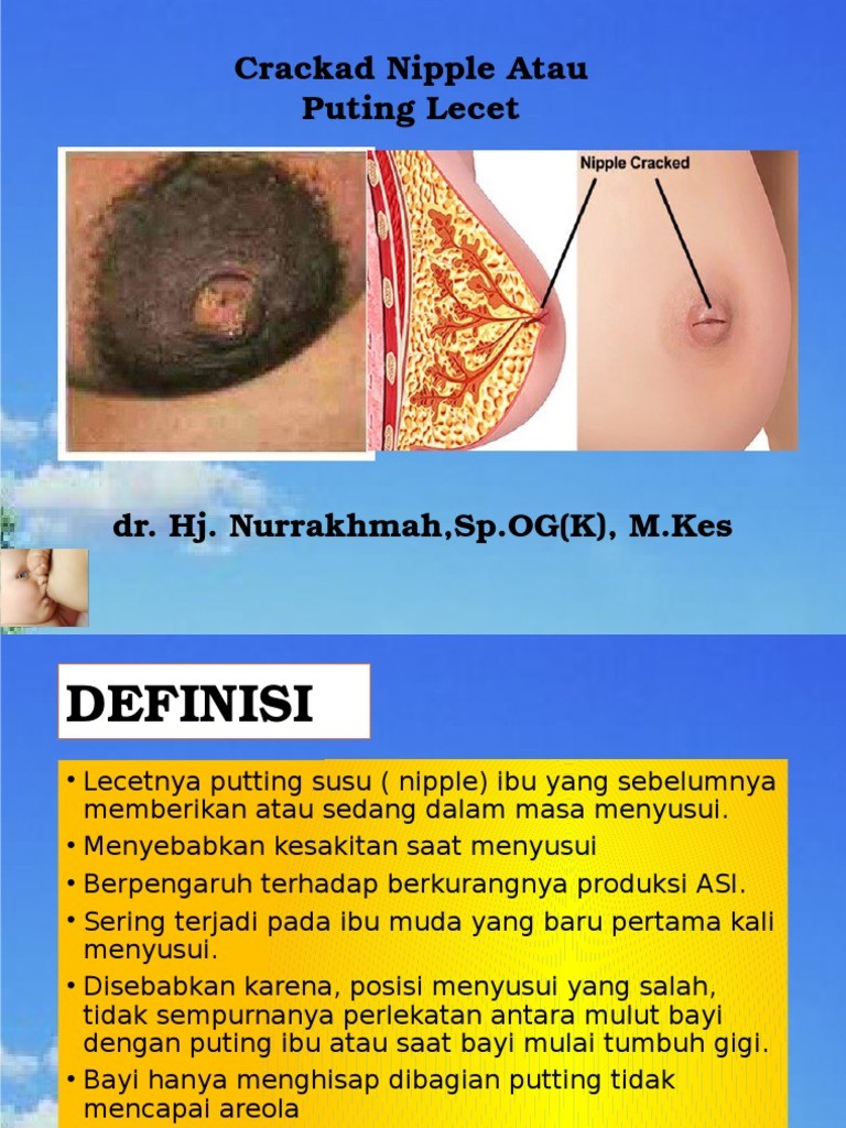 3)	Puting Lecet