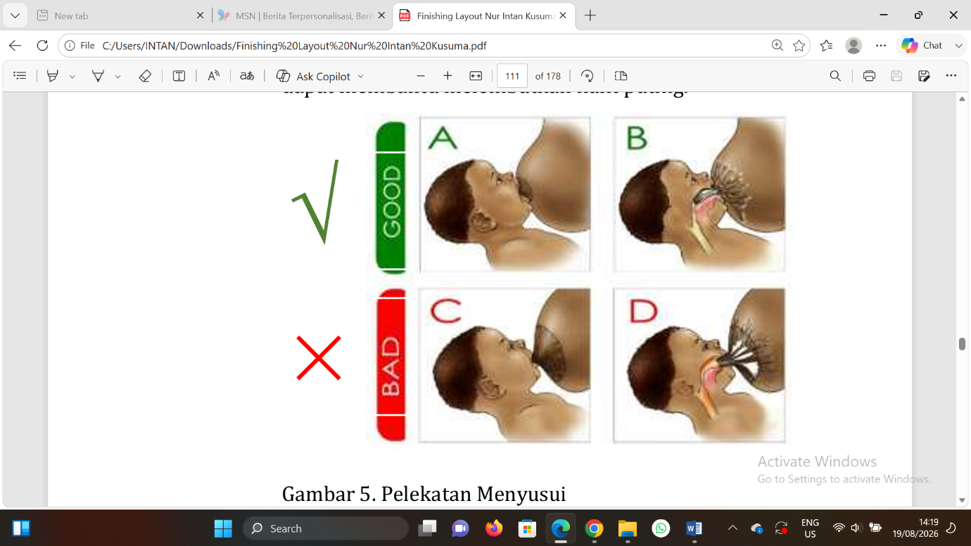 2)	Pelekatan (Latch On) yang Salah 